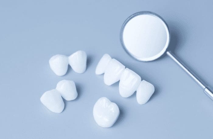 Teeth Whitening vs. Veneers: Which Is Right for You in Charleston, SC?
