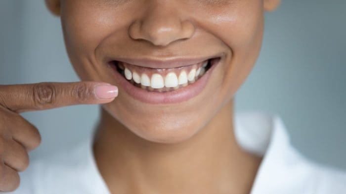 Treat Worn Teeth in Charleston, South Carolina