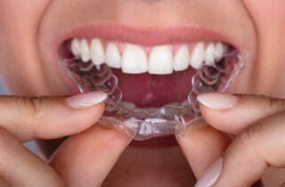 Invisalign Can Help Your Oral Health